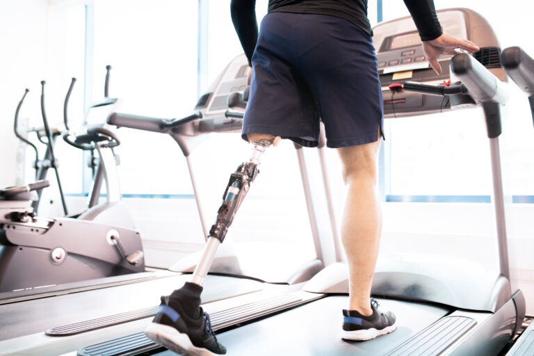 Low angle portrait of unrecognizable muscular man with prosthetic leg using walking on treadmill while working out  in modern sunlit gym